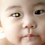 Pioneering New Approaches To Infant Eye Cancer Research